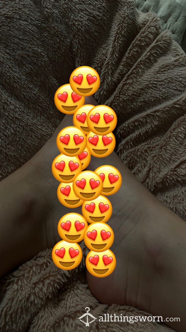 Feet Pics With Large Bunions Painted Toes