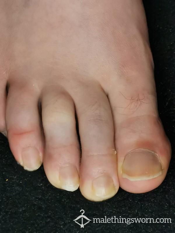 Feet With Long Nails