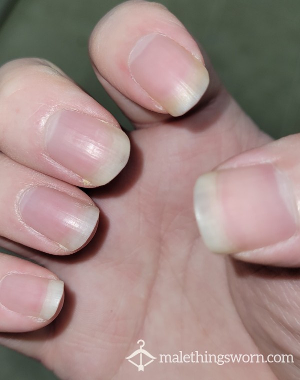 Finger Nails/toe Nails