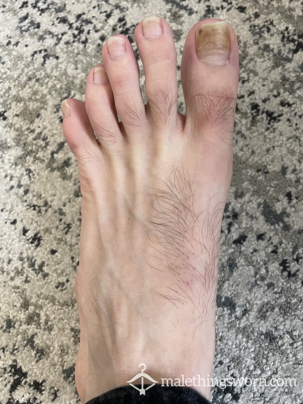 Foot fetish photo