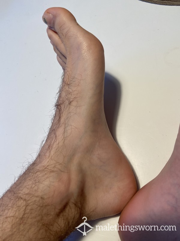 5 Pictures Of My Hairy Feet