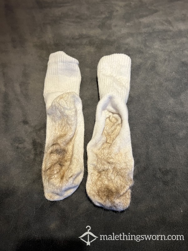 Hairy Socks