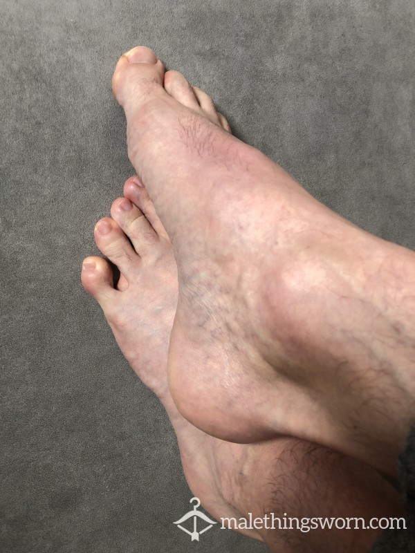 Picture of my feet photo