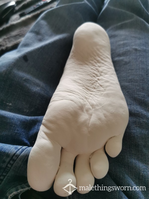 Plaster Cast Of My Foot