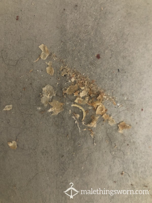 Skin From The Bottom Of My Foot
